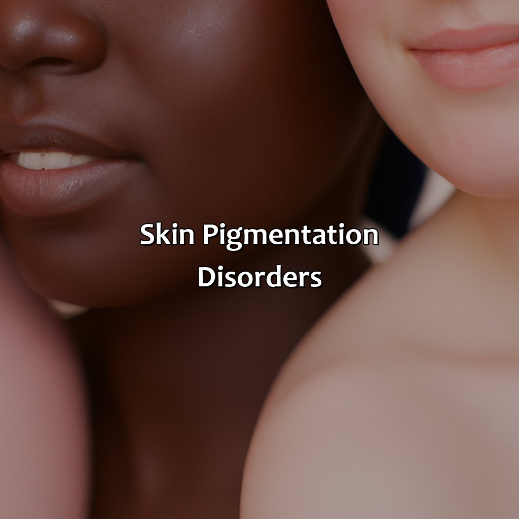 Skin Pigmentation Disorders  - Different Shades Of Skin, 
