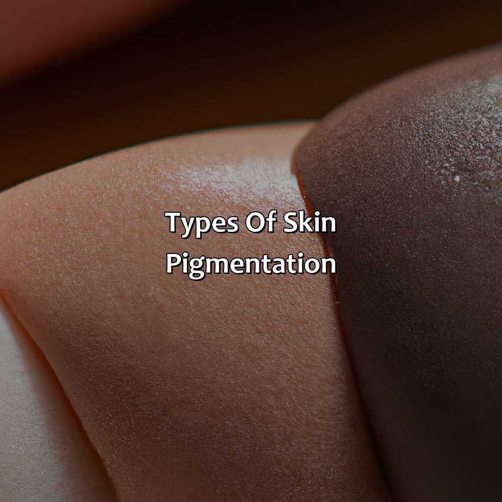 Types Of Skin Pigmentation  - Different Shades Of Skin, 