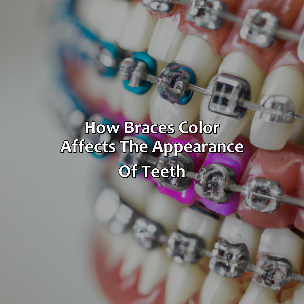 How Braces Color Affects The Appearance Of Teeth  - What Braces Color Makes Your Teeth Look Whiter, 