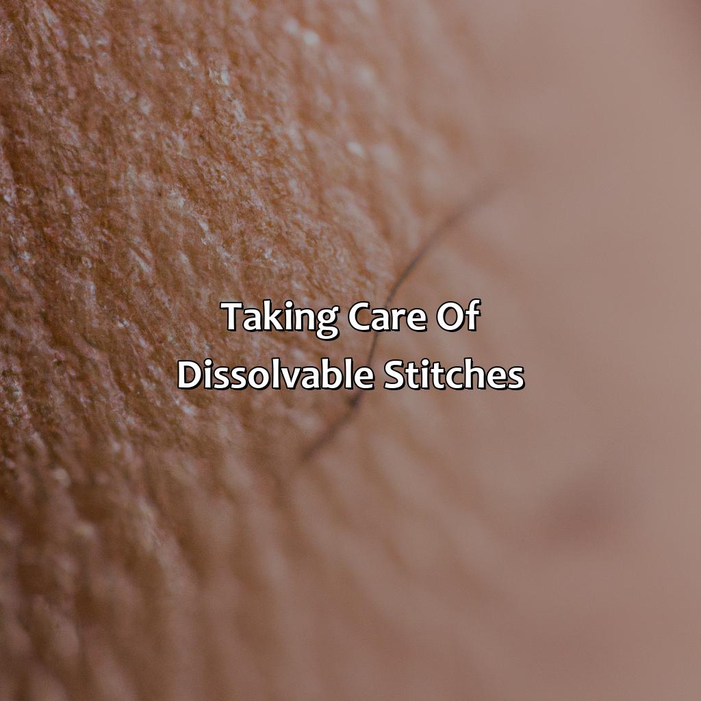 Taking Care Of Dissolvable Stitches  - What Color Are Dissolvable Stitches, 