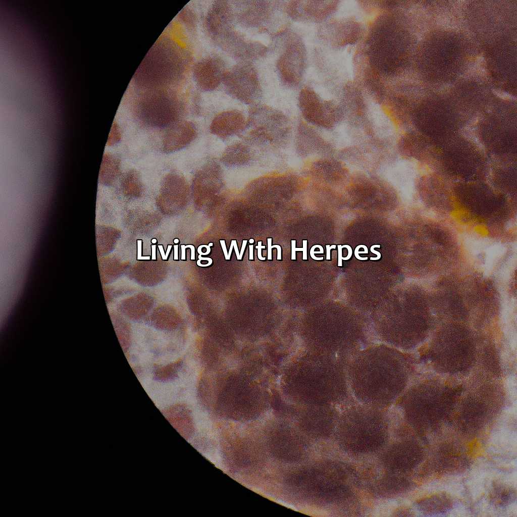 Living With Herpes  - What Color Are Herpes, 