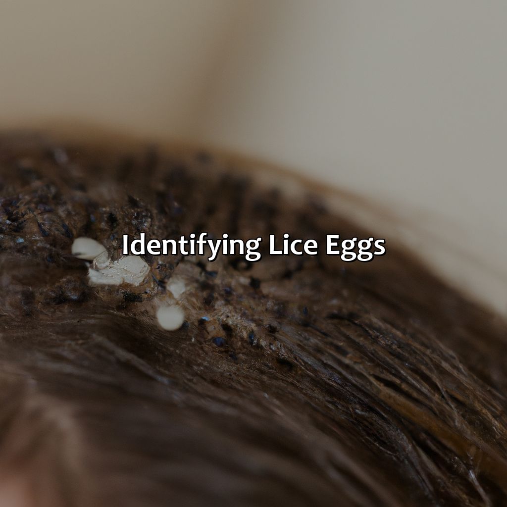 Identifying Lice Eggs  - What Color Are Lice Eggs, 
