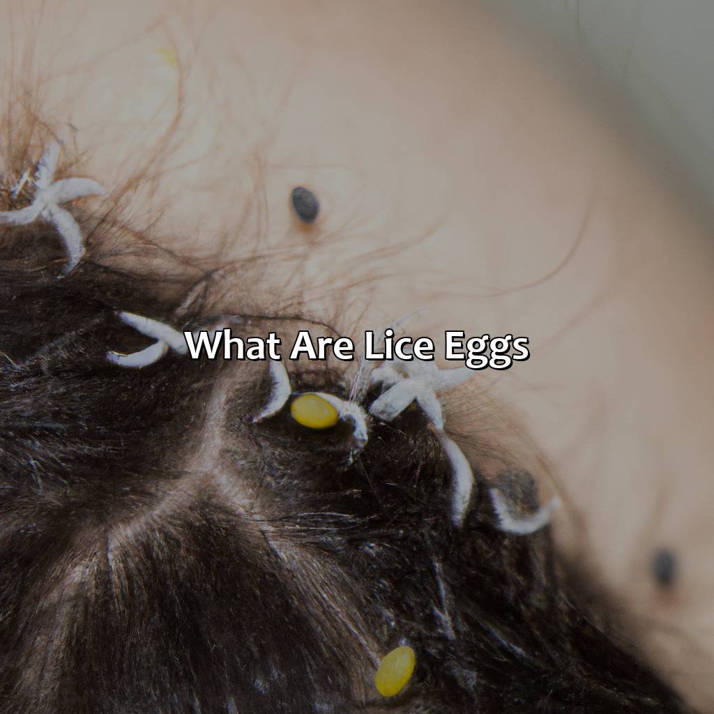 What Are Lice Eggs?  - What Color Are Lice Eggs, 