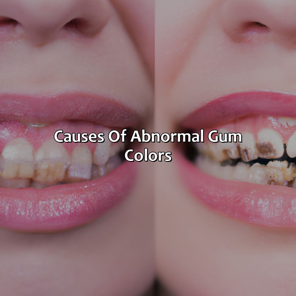 Causes Of Abnormal Gum Colors  - What Color Are Your Gums Supposed To Be, 