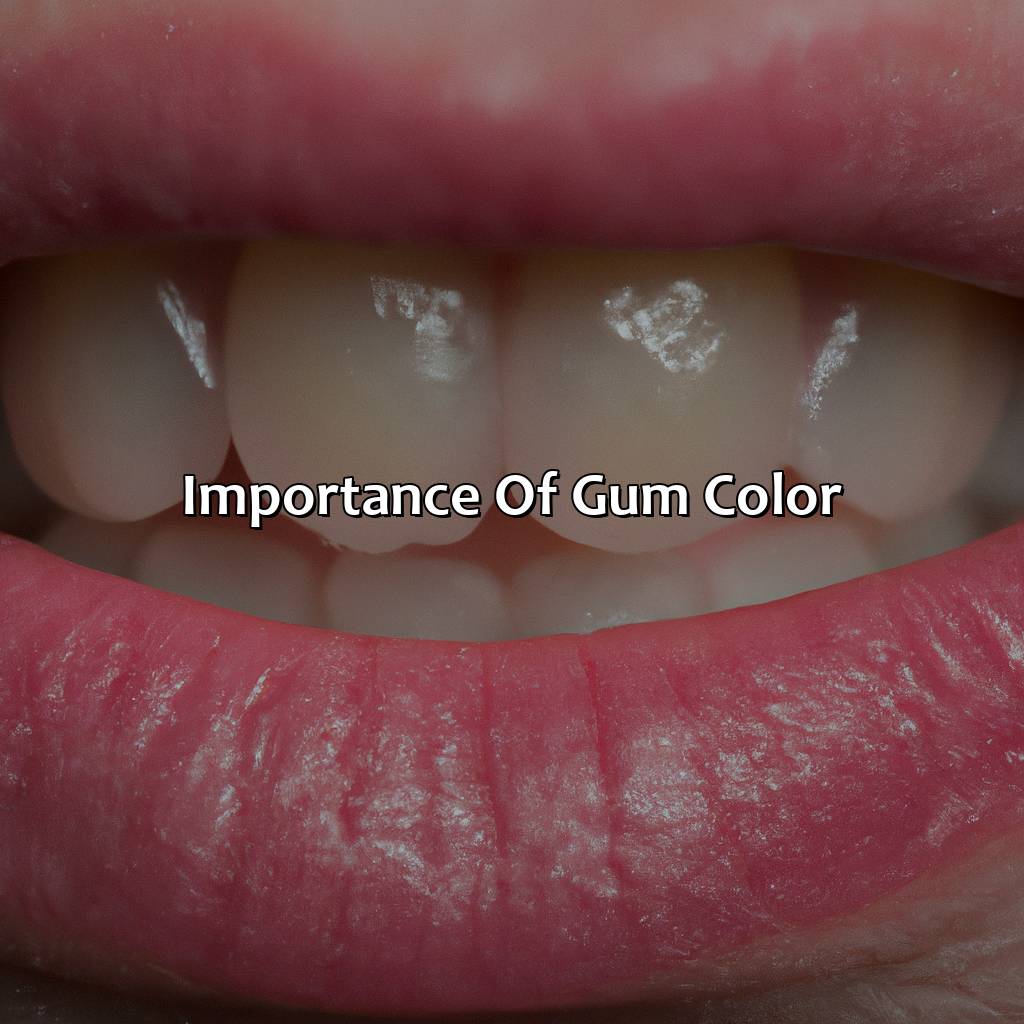 Importance Of Gum Color  - What Color Are Your Gums Supposed To Be, 