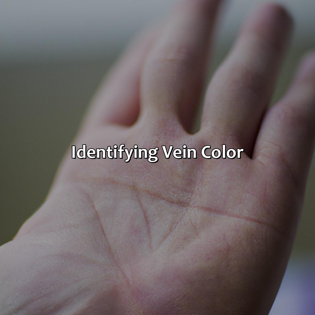Identifying Vein Color  - What Color Are Your Veins, 