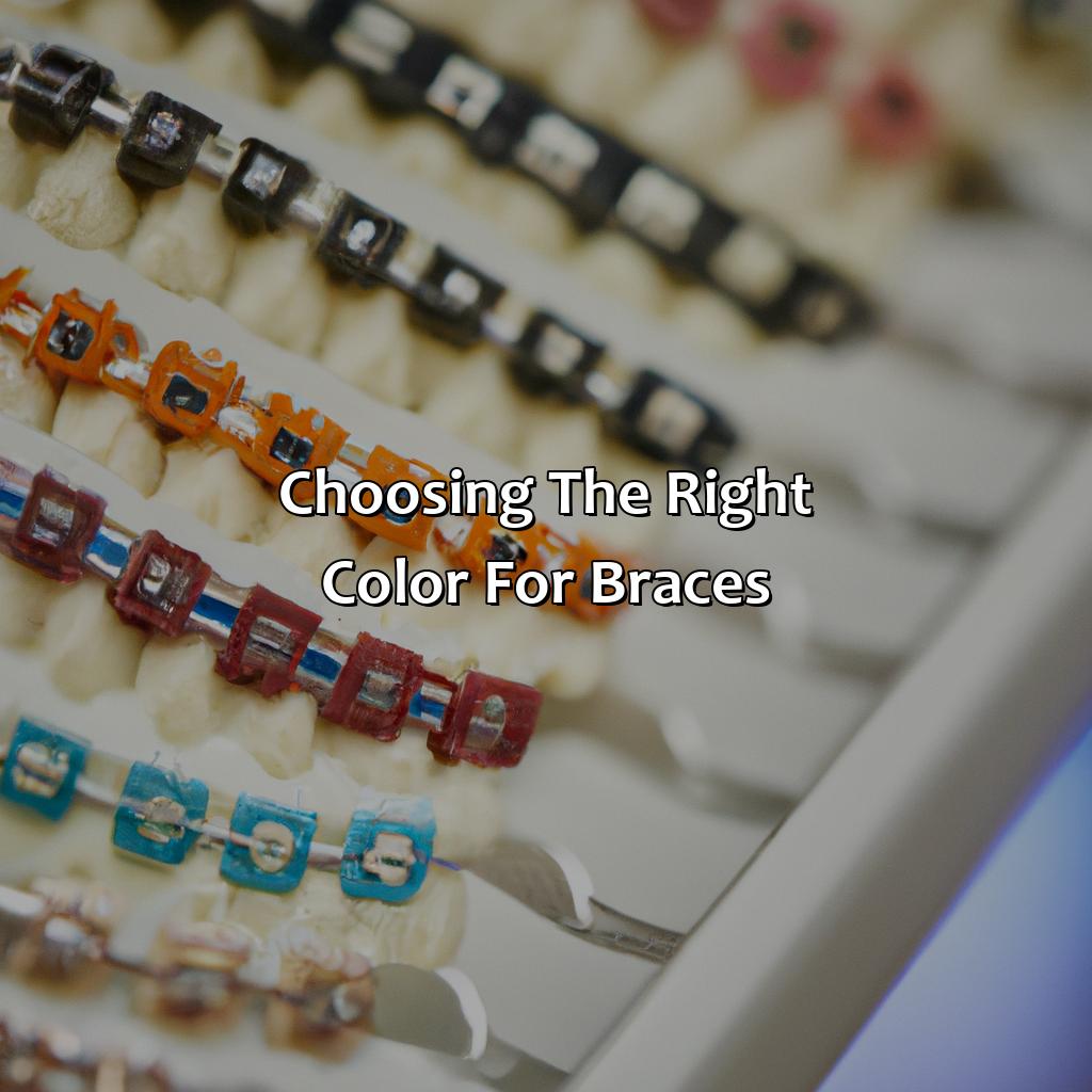 Choosing The Right Color For Braces  - What Color Braces Are There, 