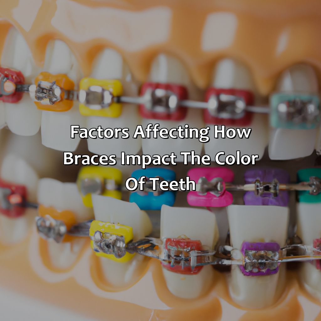Factors Affecting How Braces Impact The Color Of Teeth  - What Color Braces Make Your Teeth Look Whiter, 