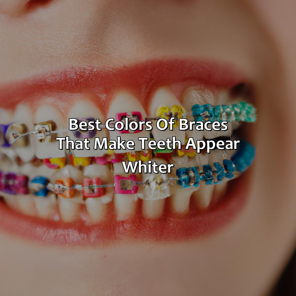 Best Colors Of Braces That Make Teeth Appear Whiter  - What Color Braces Make Your Teeth Look Whiter, 