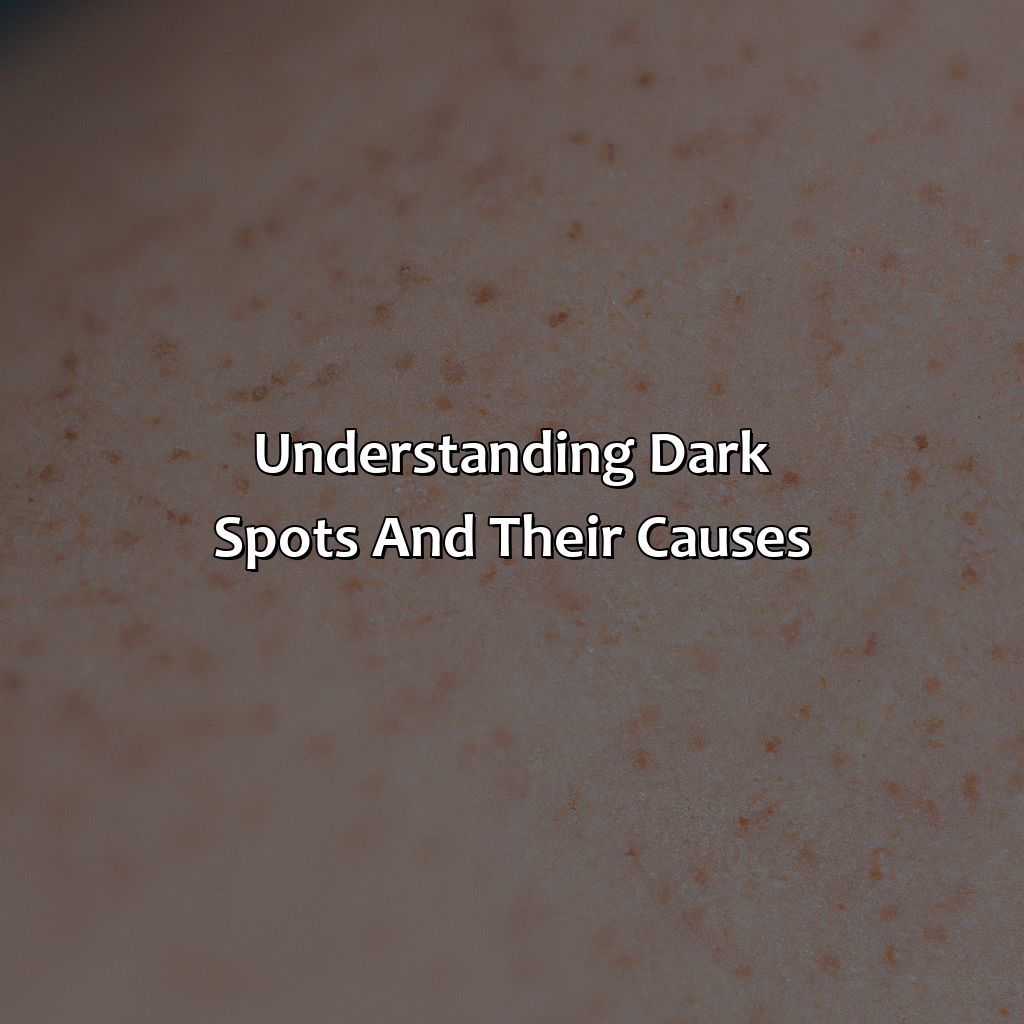 Understanding Dark Spots And Their Causes  - What Color Concealer For Dark Spots, 