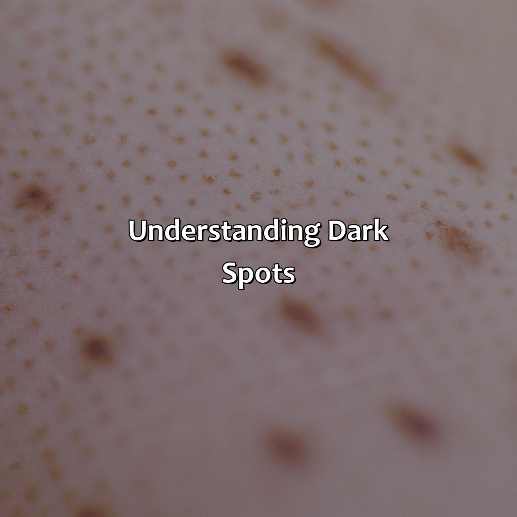 Understanding Dark Spots  - What Color Corrects Dark Spots, 