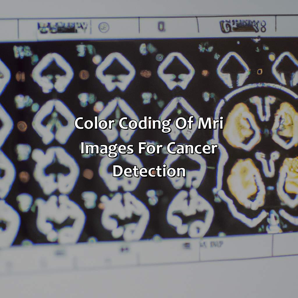 Color Coding Of Mri Images For Cancer Detection  - What Color Does Cancer Show Up On Mri, 