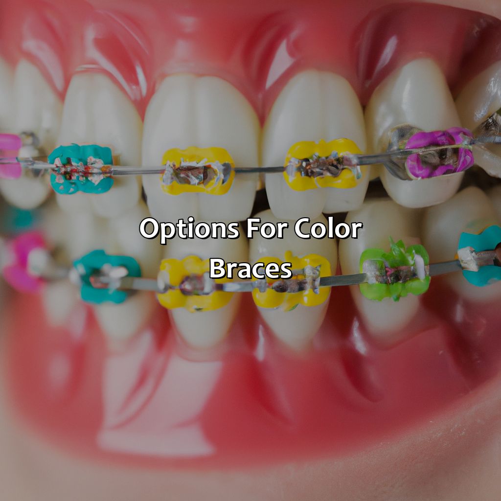 Options For Color Braces  - What Color Is Best For Braces, 