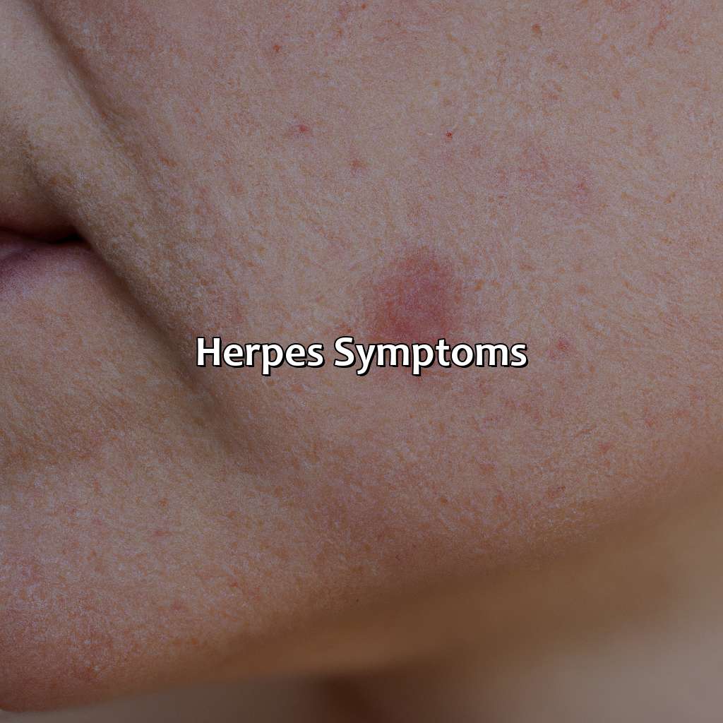 Herpes Symptoms  - What Color Is Herpes, 
