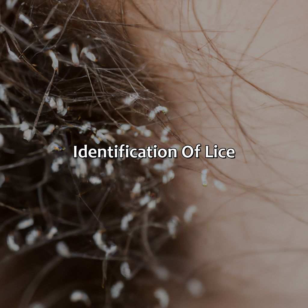 Identification Of Lice  - What Color Is Lice, 