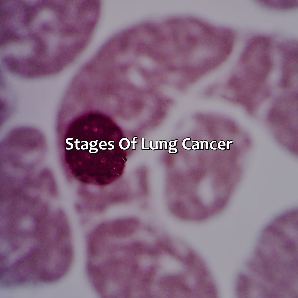 Stages Of Lung Cancer  - What Color Is Lung Cancer, 