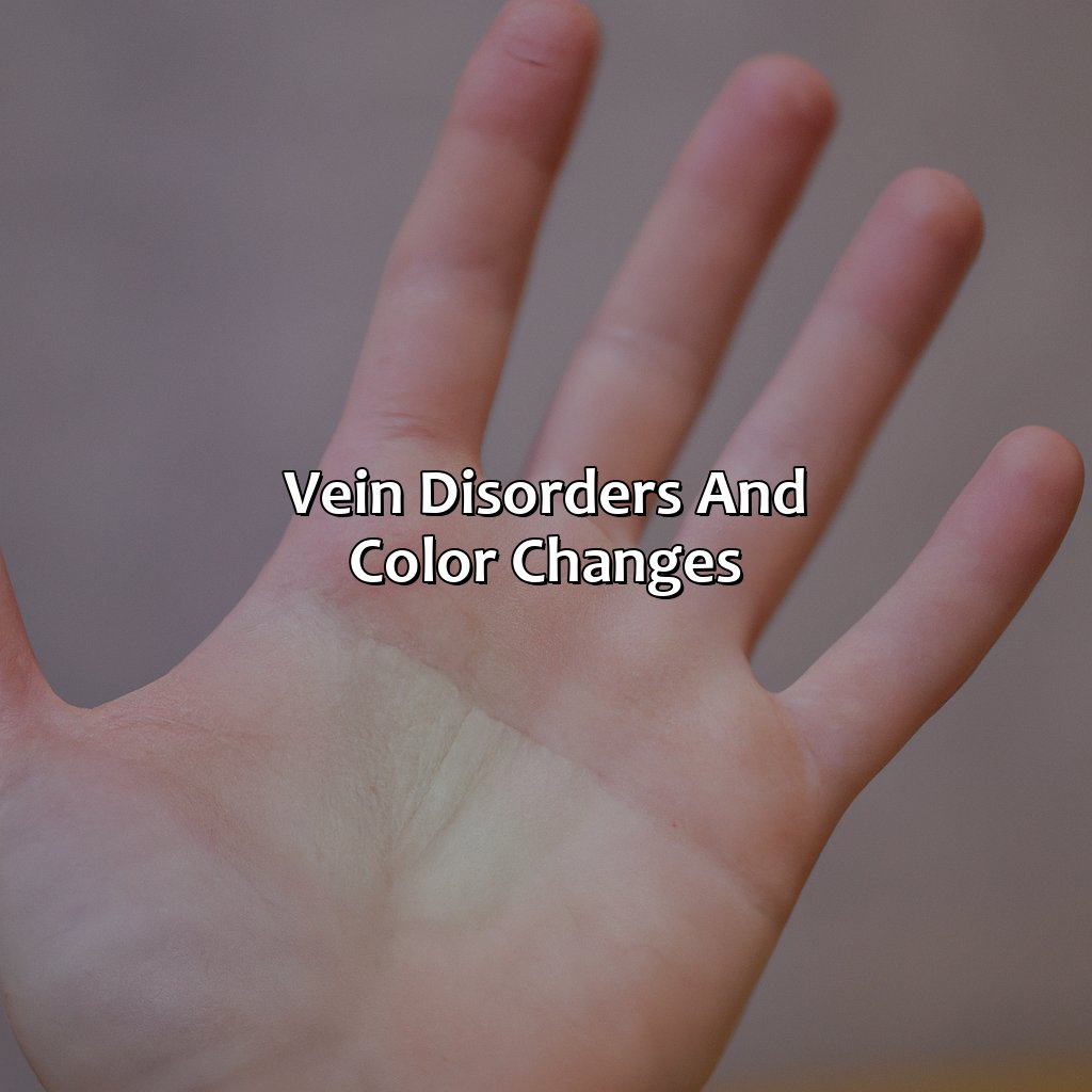 Vein Disorders And Color Changes  - What Color Is Your Veins, 