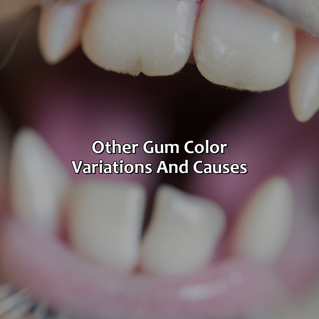 Other Gum Color Variations And Causes  - What Color Should Dogs Gums Be, 