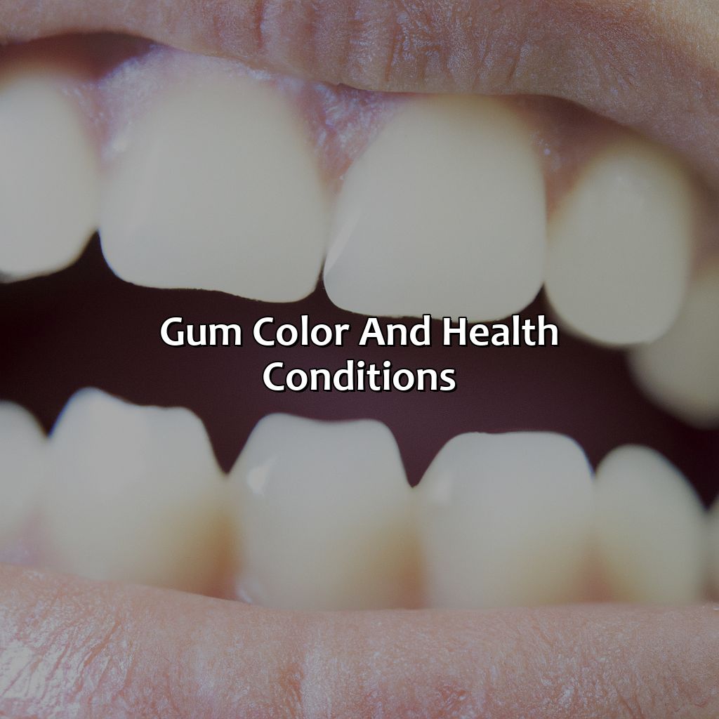 Gum Color And Health Conditions  - What Color Should Gums Be, 
