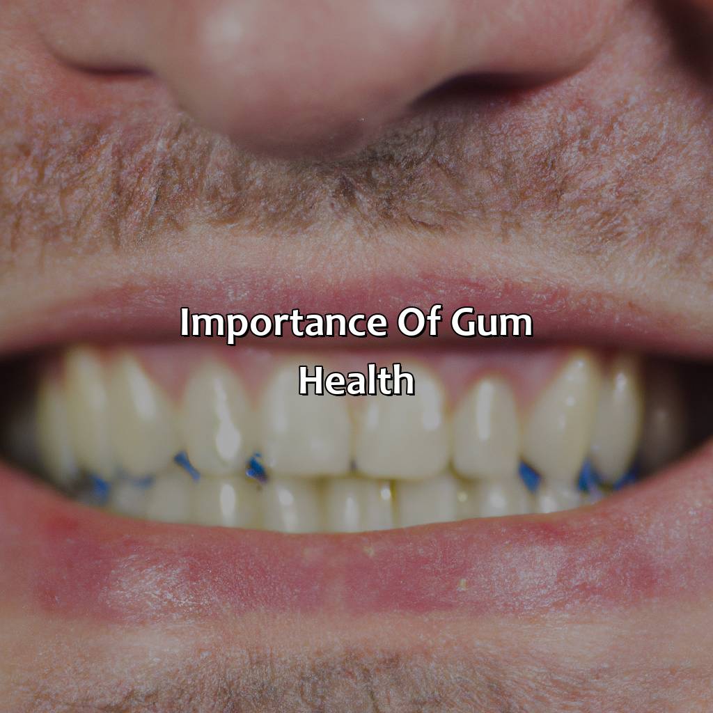 Importance Of Gum Health  - What Color Should Gums Be, 