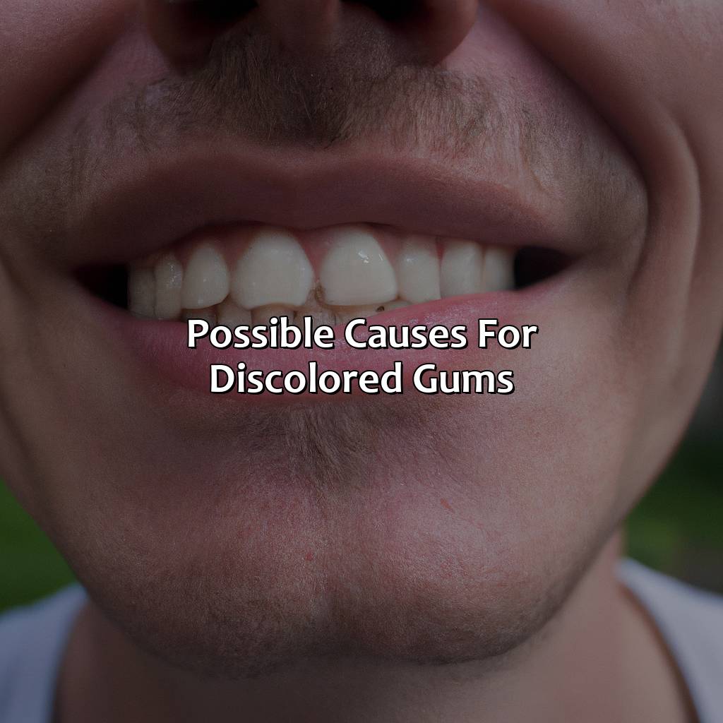 Possible Causes For Discolored Gums  - What Color Should My Gums Be, 