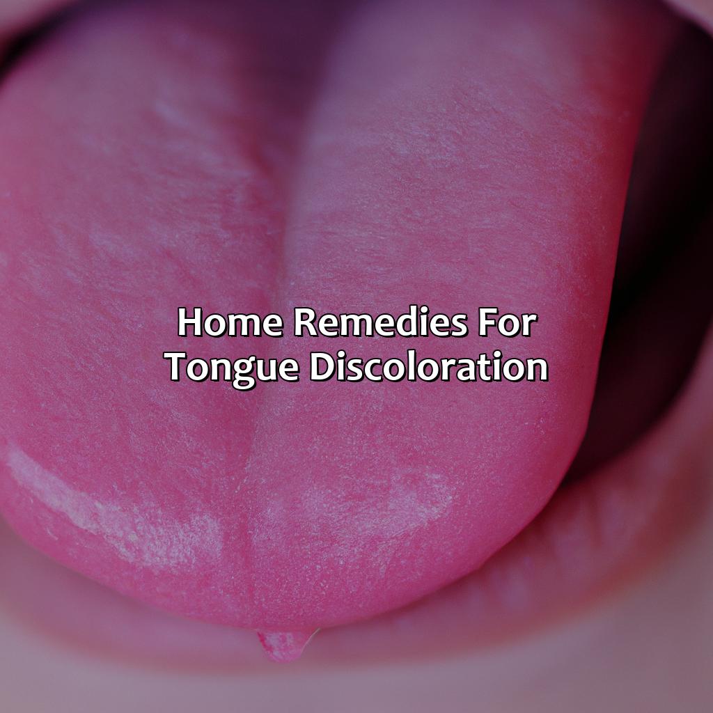 Home Remedies For Tongue Discoloration  - What Color Should My Tongue Be, 