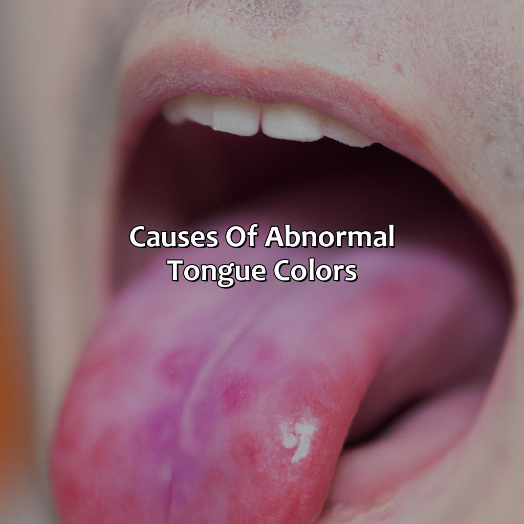 Causes Of Abnormal Tongue Colors  - What Color Should My Tongue Be, 