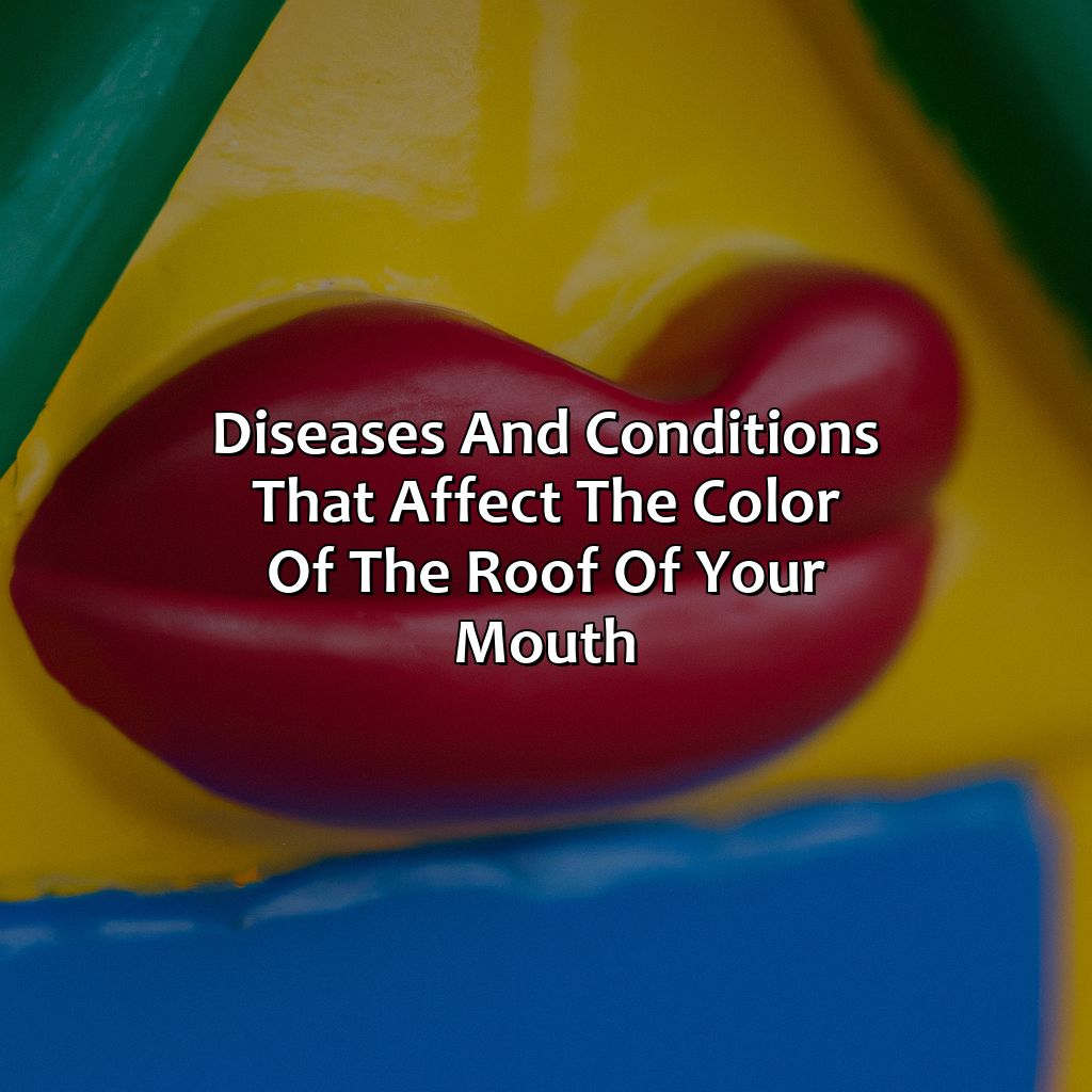 Diseases And Conditions That Affect The Color Of The Roof Of Your Mouth  - What Color Should The Roof Of Your Mouth Be, 