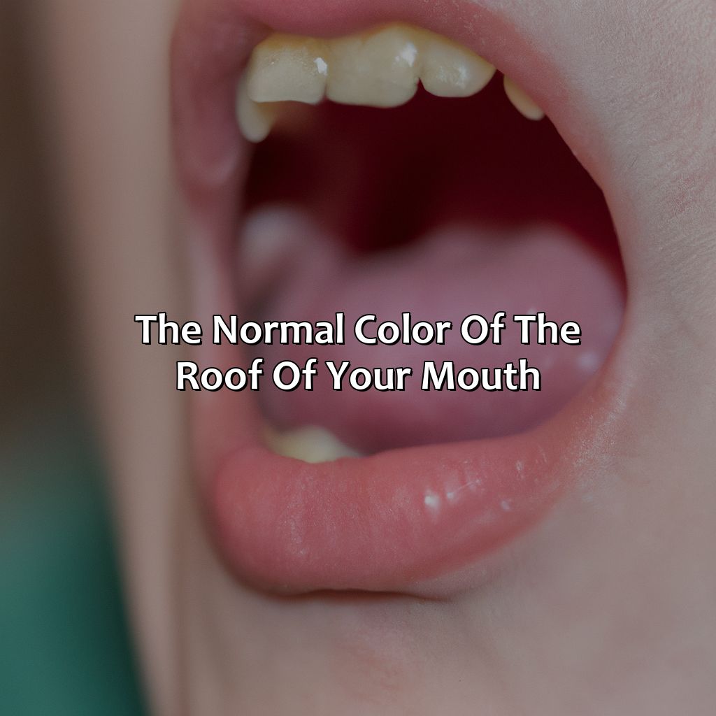 The Normal Color Of The Roof Of Your Mouth  - What Color Should The Roof Of Your Mouth Be, 