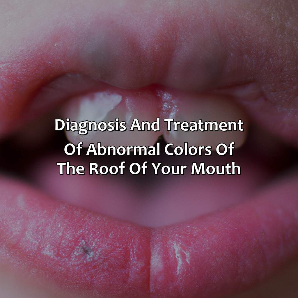 Diagnosis And Treatment Of Abnormal Colors Of The Roof Of Your Mouth  - What Color Should The Roof Of Your Mouth Be, 