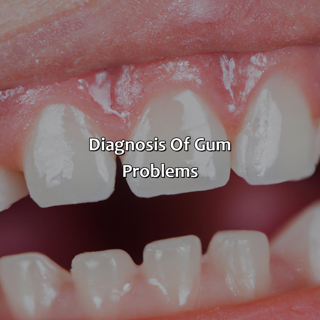 Diagnosis Of Gum Problems  - What Color Should Your Gums Be, 