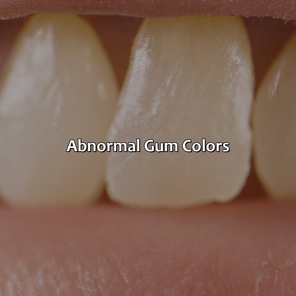 Abnormal Gum Colors  - What Color Should Your Gums Be, 