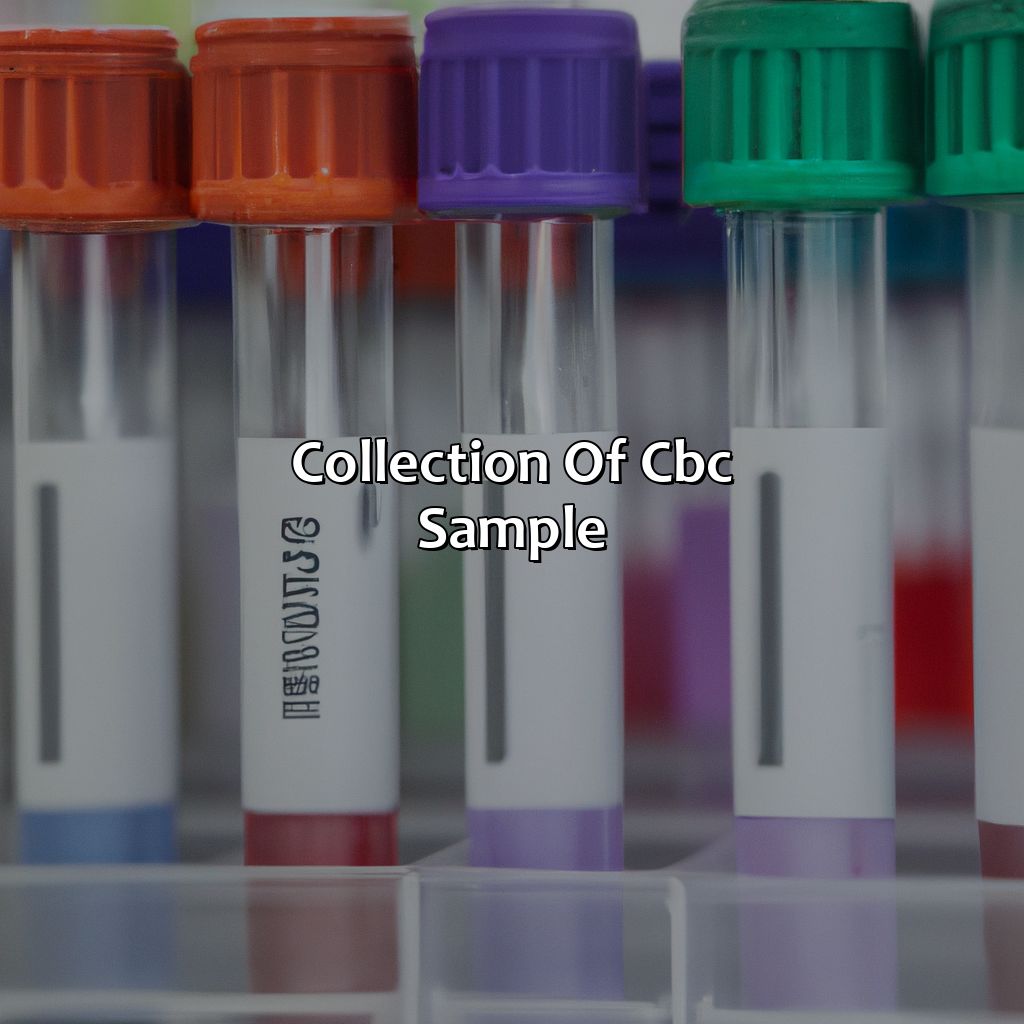 Collection Of Cbc Sample  - What Color Tube For Cbc, 