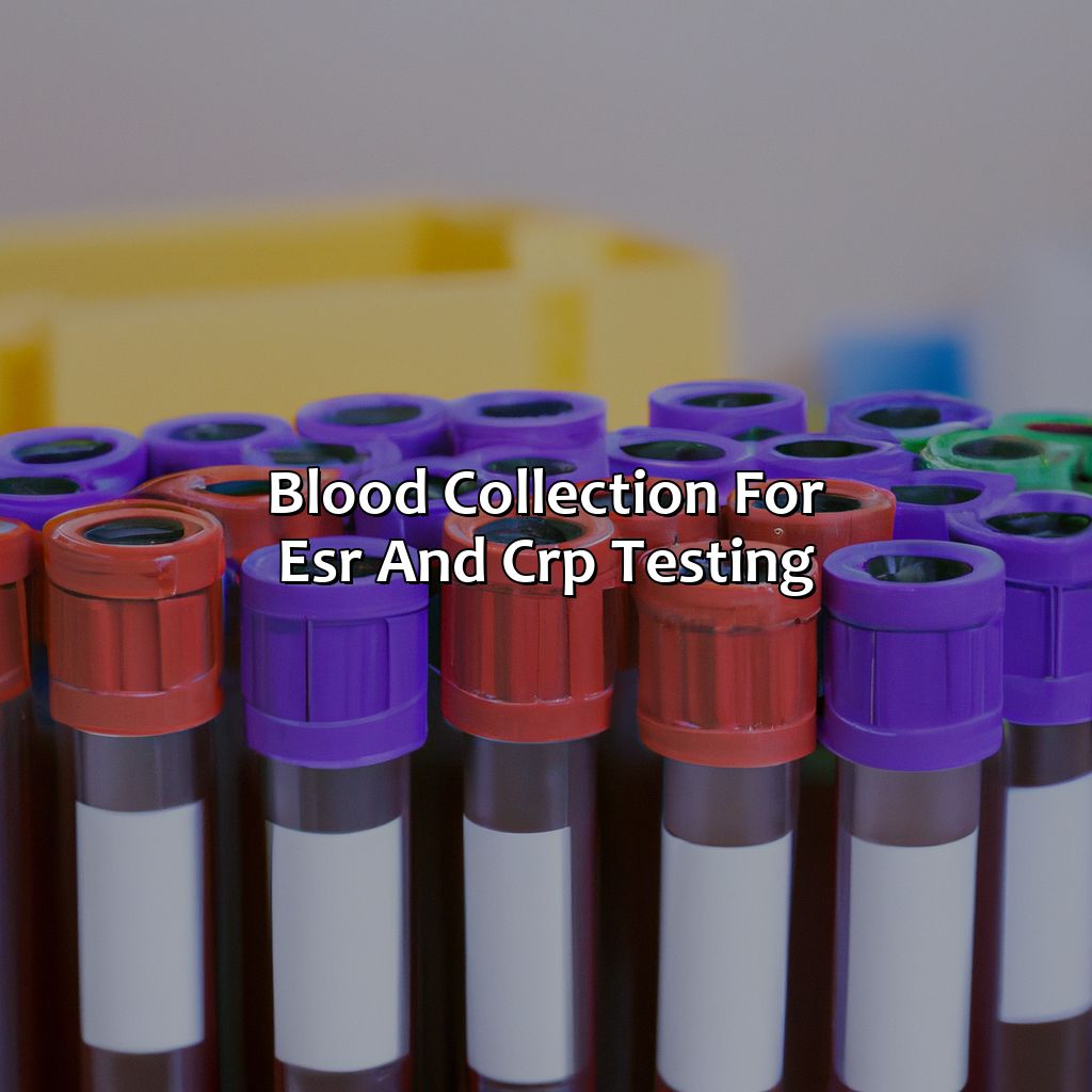 Blood Collection For Esr And Crp Testing  - What Color Tube For Esr And Crp, 