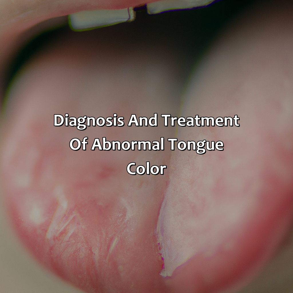 Diagnosis And Treatment Of Abnormal Tongue Color  - What Does The Color Of My Tongue Mean, 