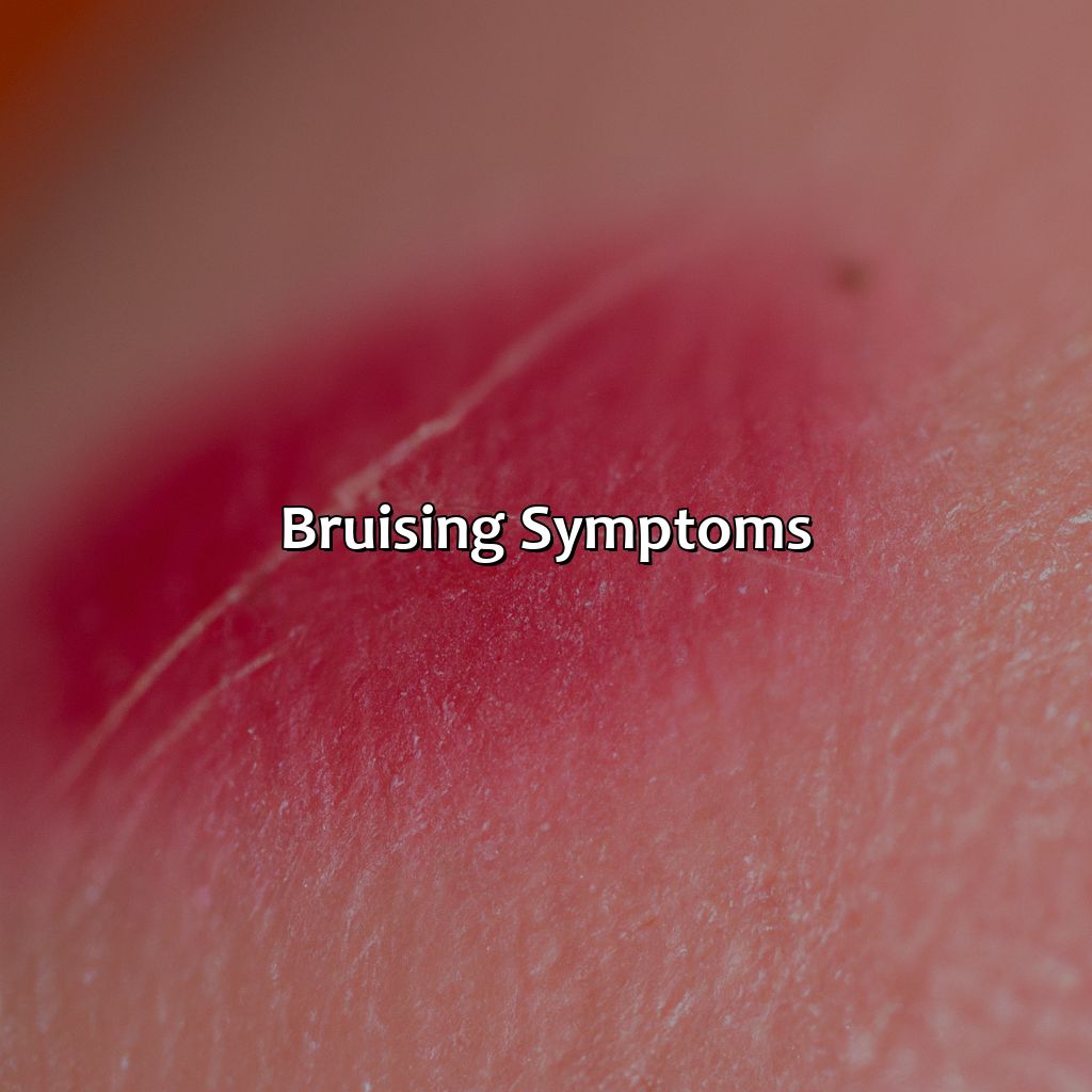 Bruising Symptoms  - What Does The Color Of The Bruises Mean, 