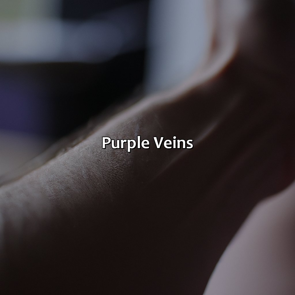 Purple Veins  - What Does The Color Of Your Veins Mean, 