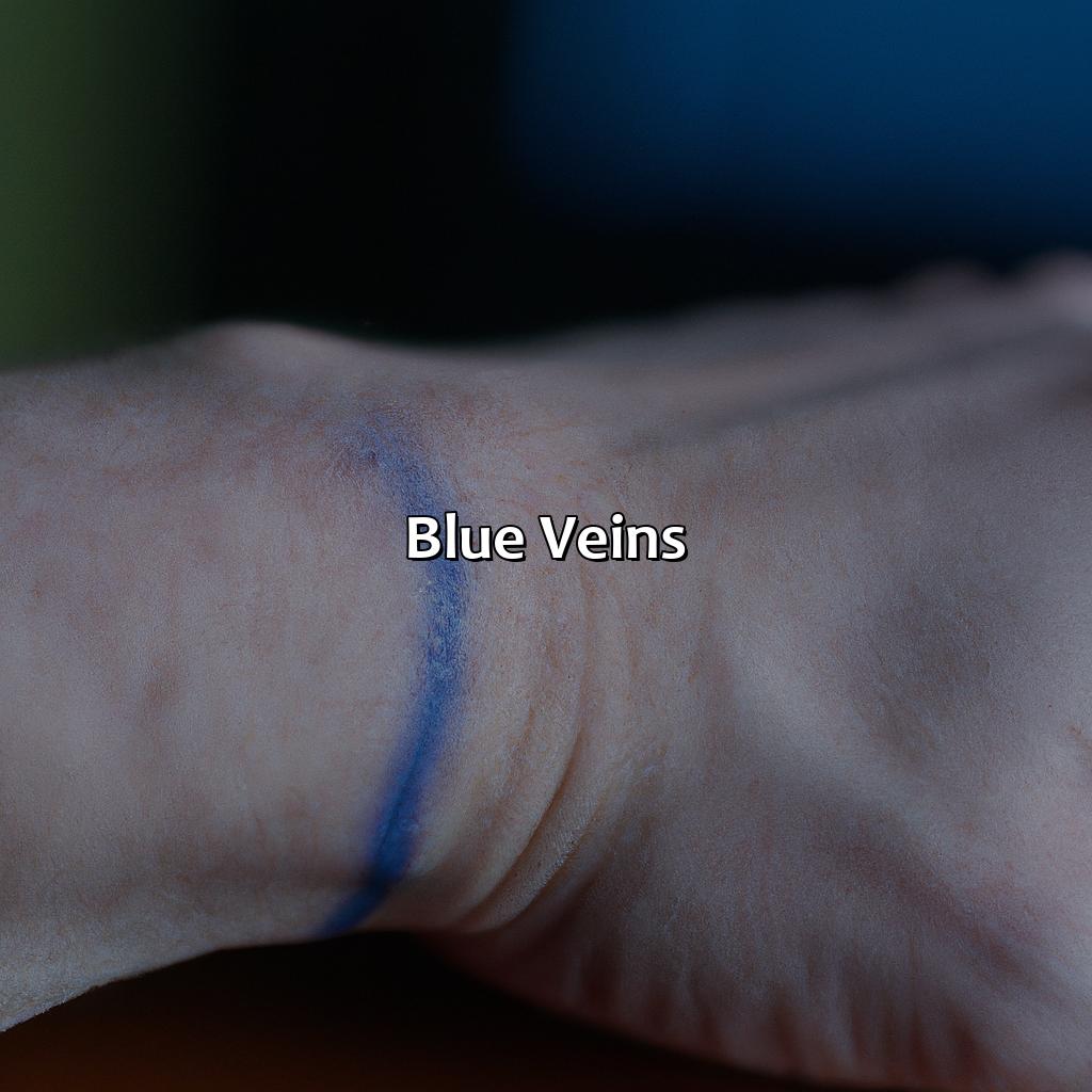 Blue Veins  - What Does The Color Of Your Veins Mean, 