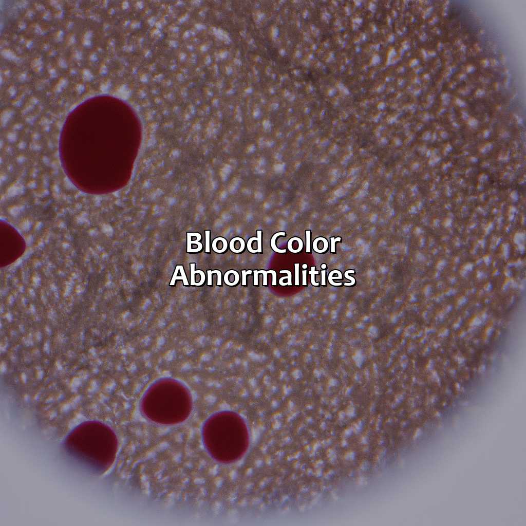 Blood Color Abnormalities  - What Gives Blood Its Color, 