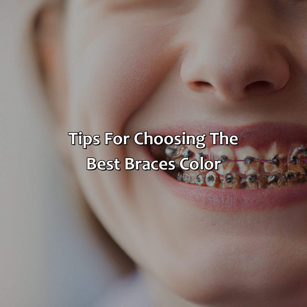 Tips For Choosing The Best Braces Color  - What Is The Best Braces Color, 