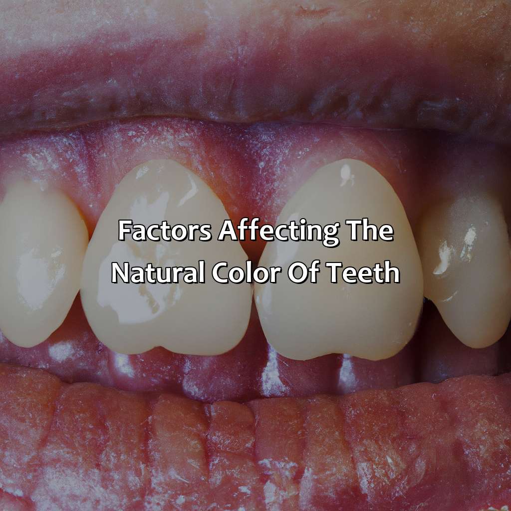 Factors Affecting The Natural Color Of Teeth  - What Is The Natural Color Of Teeth, 