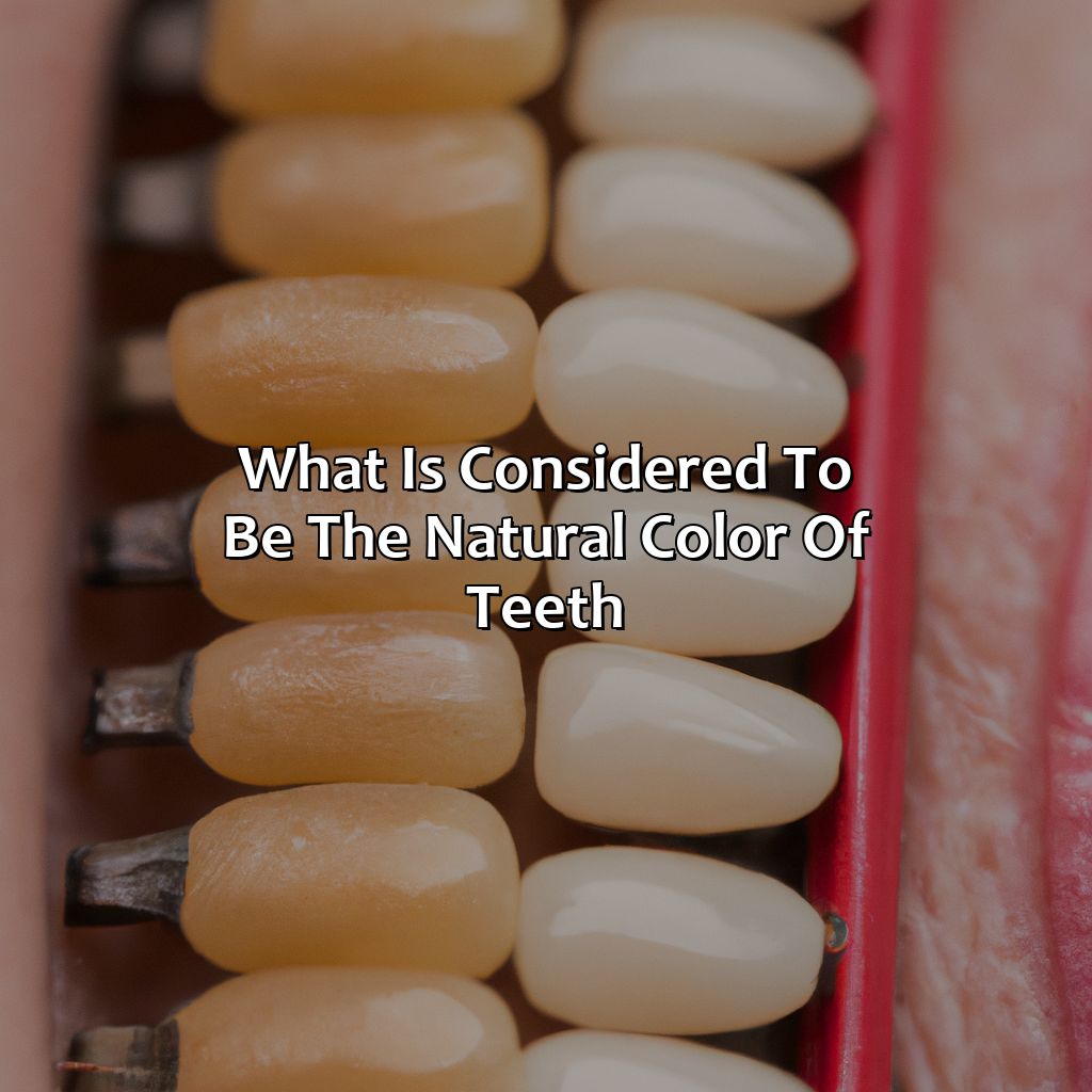 What Is Considered To Be The Natural Color Of Teeth?  - What Is The Natural Color Of Teeth, 