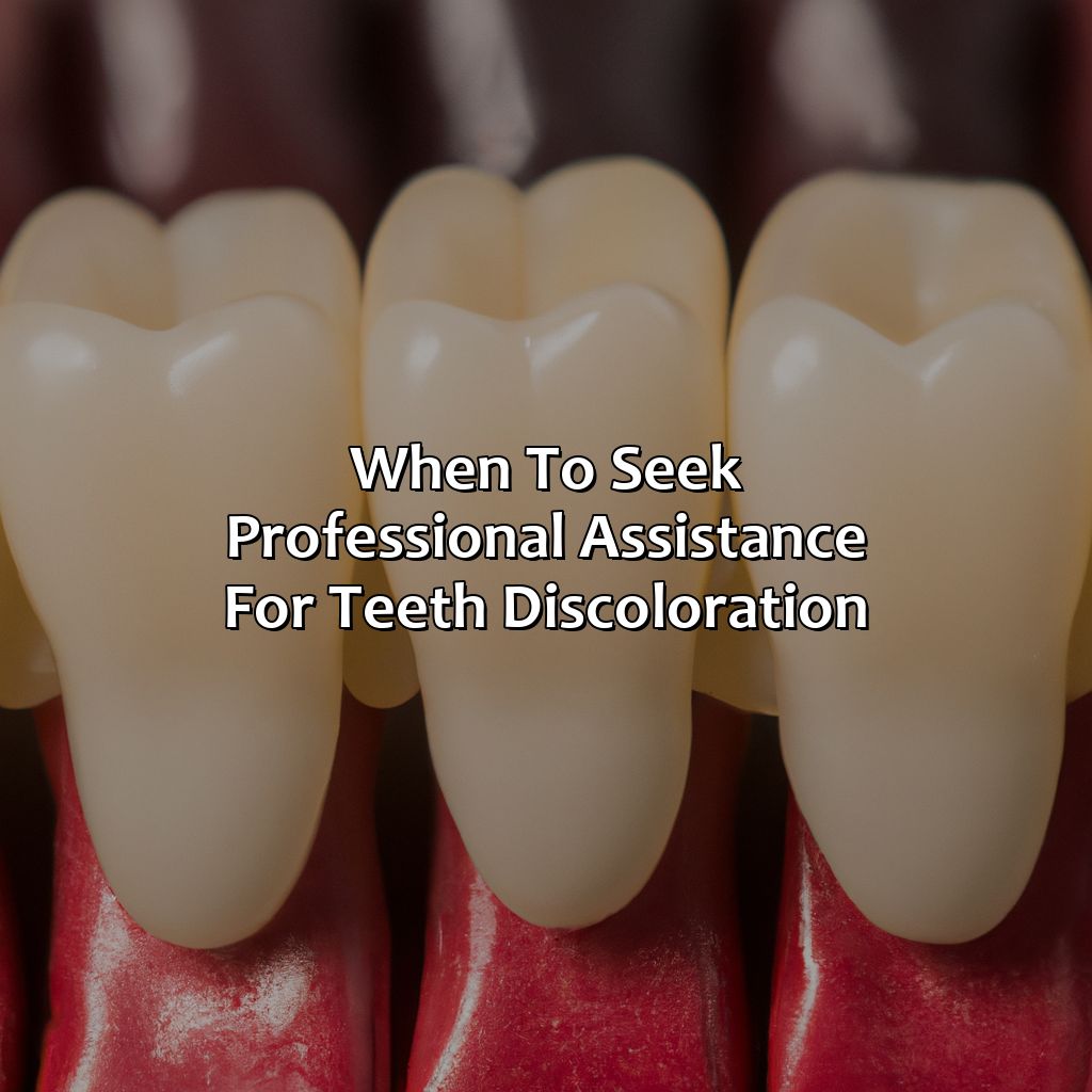 When To Seek Professional Assistance For Teeth Discoloration  - What Is The Natural Color Of Teeth, 