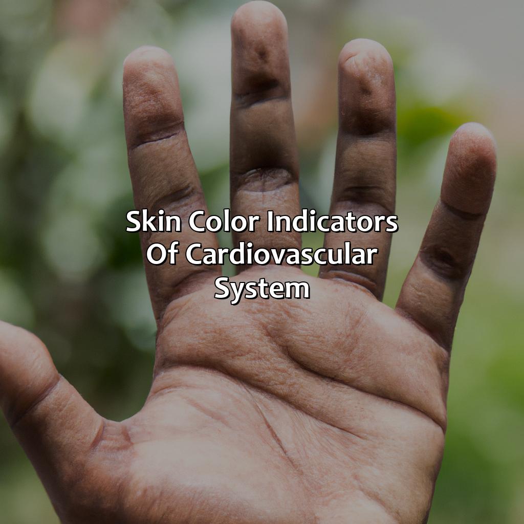 Skin Color Indicators Of Cardiovascular System  - What Might Skin Color, Temperature, Or Moisture Indicate About The Patients Cardiovascular System?, 